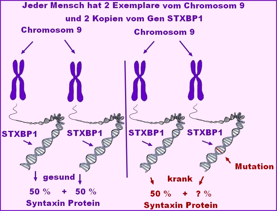 SYTXBP1 Syndrom